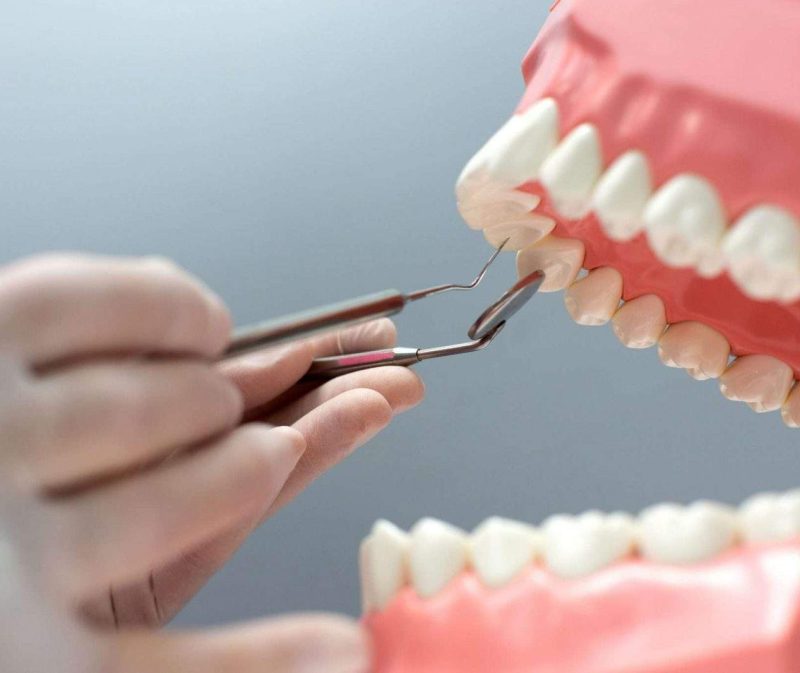 nurse practicing layout jaw with teeth scaled